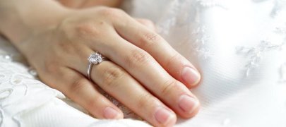 Why does irritation appear under a wedding ring?