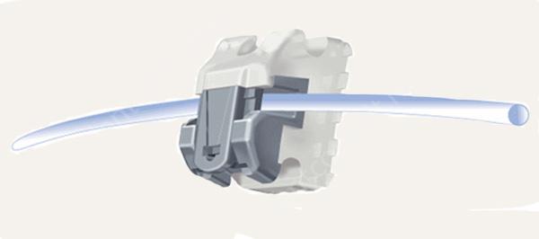 Self-ligating braces attachment system